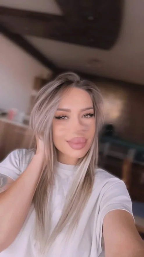 Erica