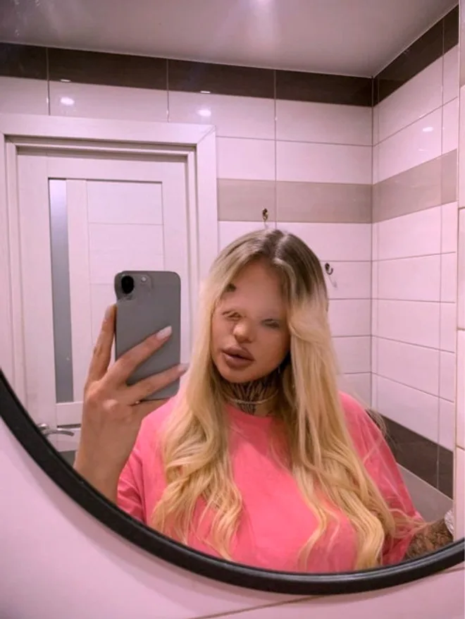 Nika
